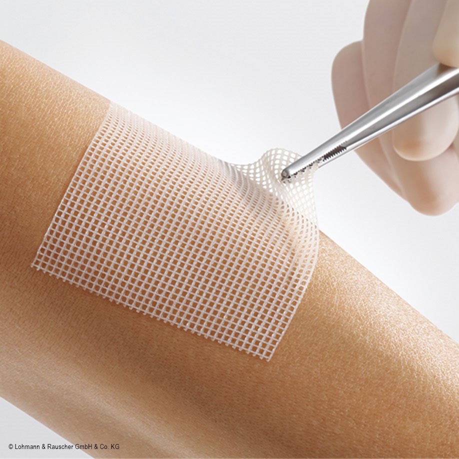 Lomatuell PRO Polyesterfaser-Gittertüll