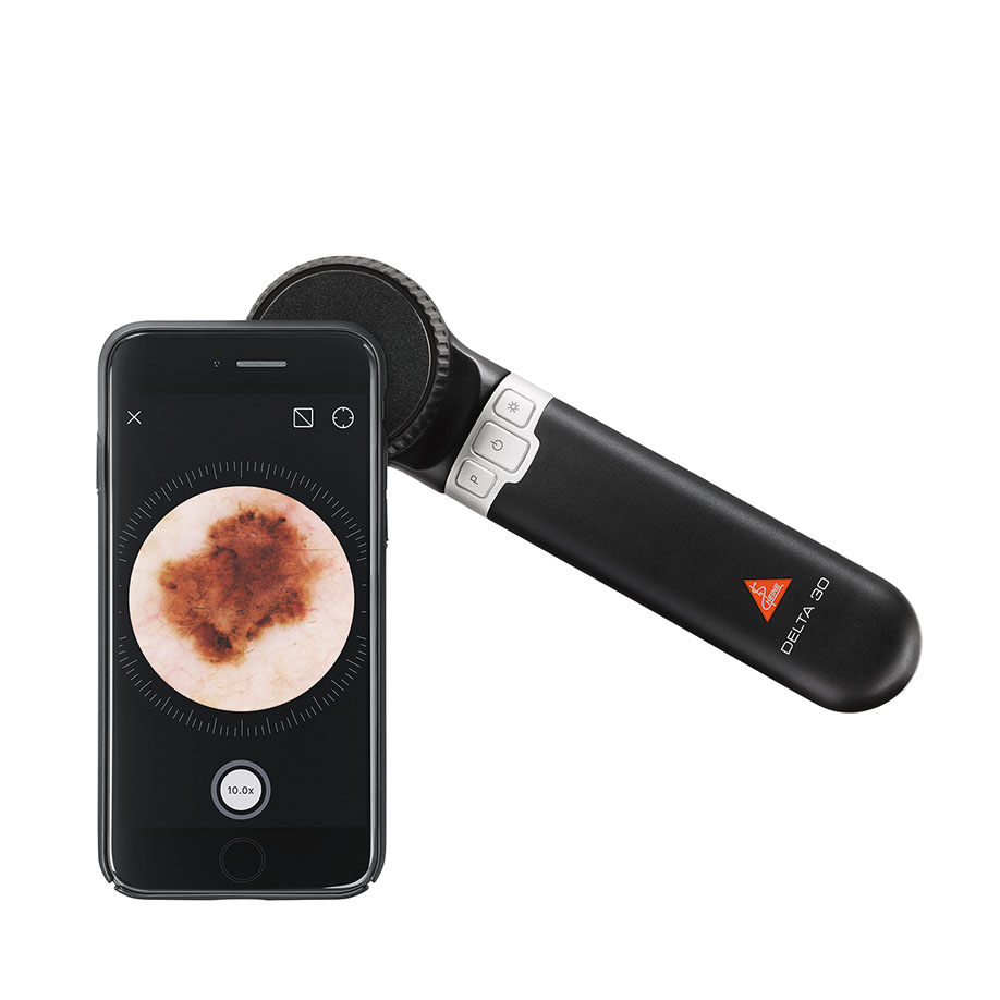 DELTA30 Dermatoscope LED with contact  disc with scale, USB cable with med.