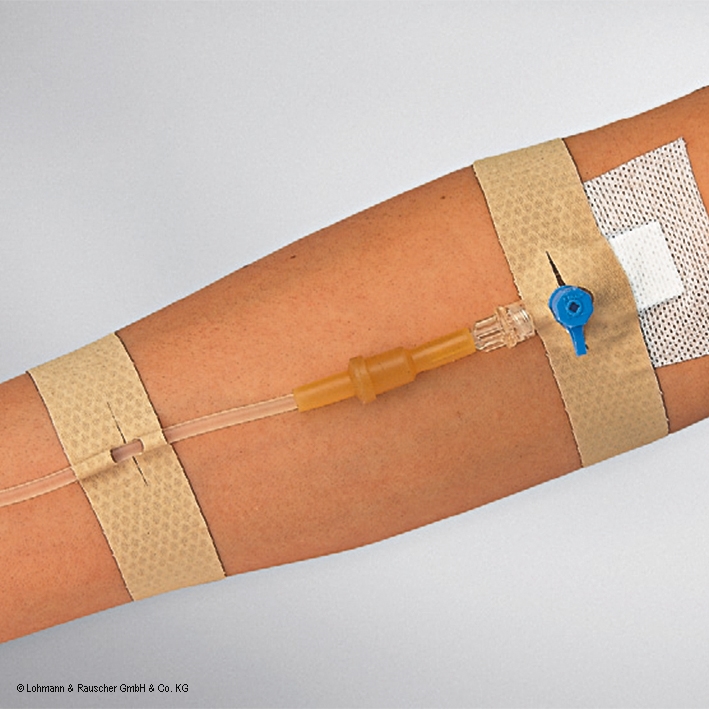 Curafix i.v. classic 2,5 x 12,5 cm