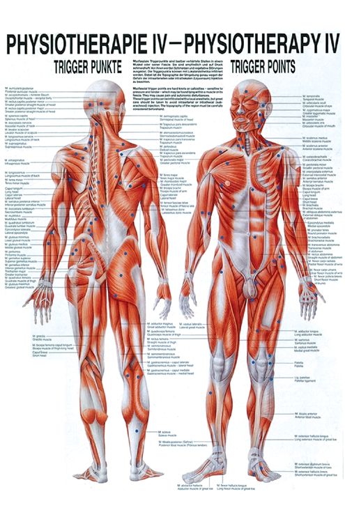 anat. Poster: Physiotherapie Triggerpunkte, 50 x 70 cm, Papier
