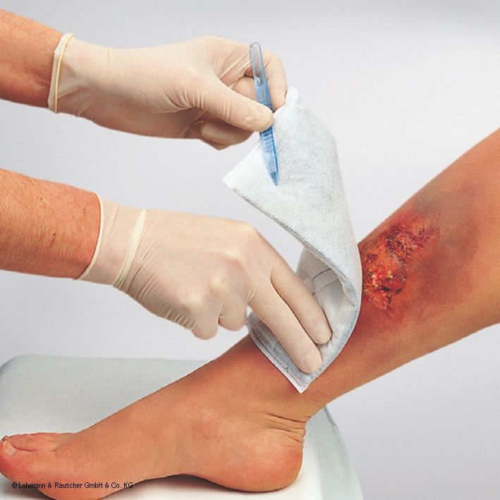 Vliwaktiv Aktivkohleverband, steril,