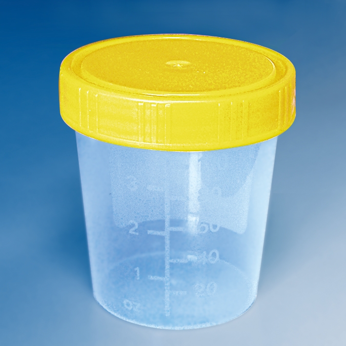 Urinbecher 100 ml mit Schraubdeckel gelb